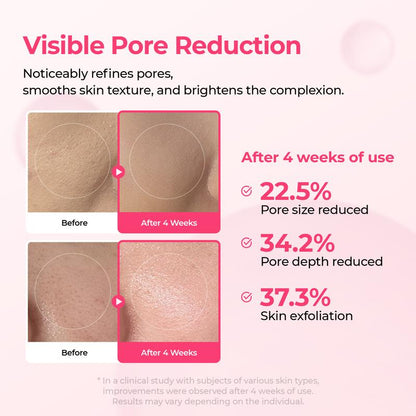 Pore & Spot Treatment Duo – Shrinks Pores and Fades Blemishes for Clear, Radiant Skin