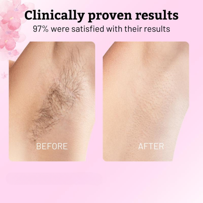 Silkxivo™ Cyperus Rotundus Serum - Progressive Hair Reduction & Skin Renewal Treatment