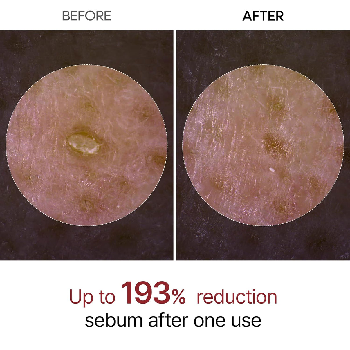 Exfoliating Rice Peel Duo – Instantly Removes Dead Skin for Smooth, Glowing Skin