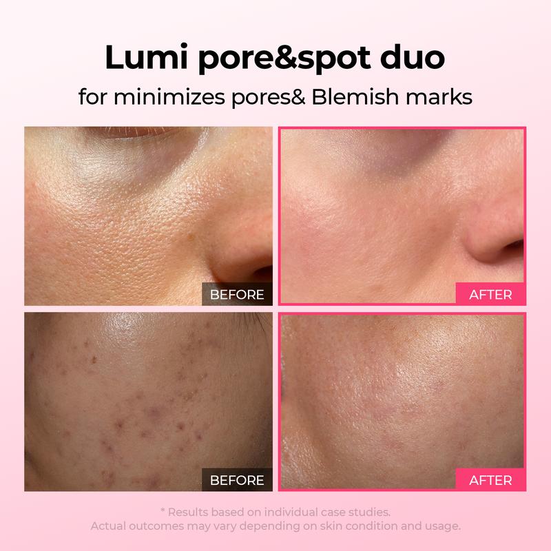 Pore & Spot Treatment Duo – Shrinks Pores and Fades Blemishes for Clear, Radiant Skin
