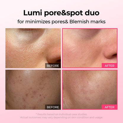 Pore & Spot Treatment Duo – Shrinks Pores and Fades Blemishes for Clear, Radiant Skin