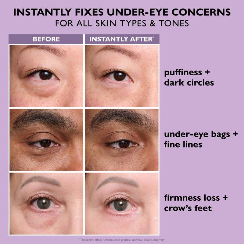 VisiLift™ Instant Eye Tightener – Look Younger in Minutes, Lasts All Day