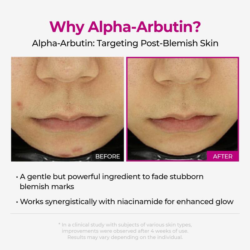 Pore & Spot Treatment Duo – Shrinks Pores and Fades Blemishes for Clear, Radiant Skin