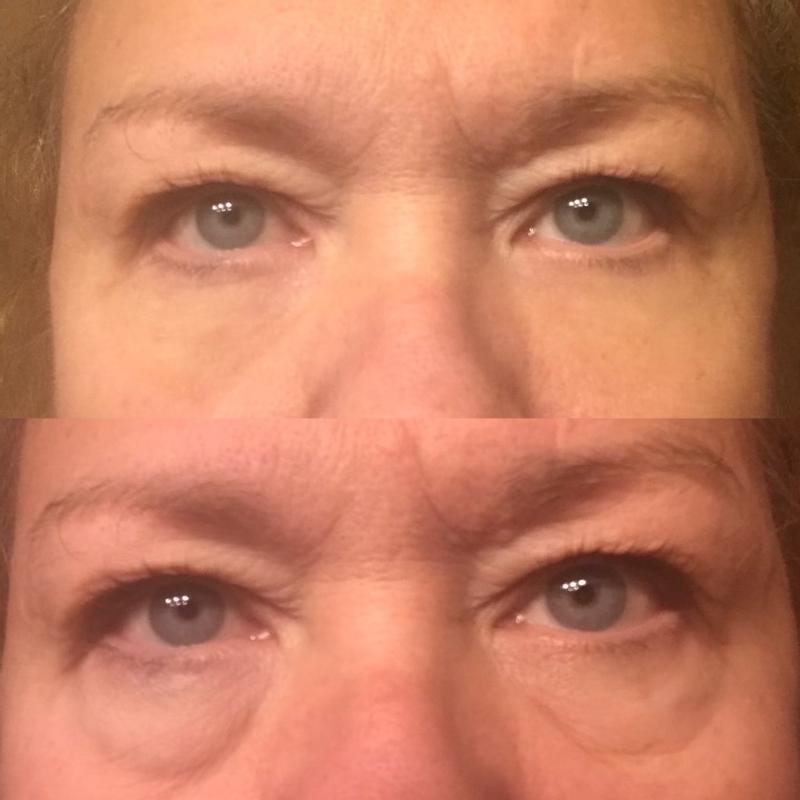 Nail Growth Oil & Serum on nails